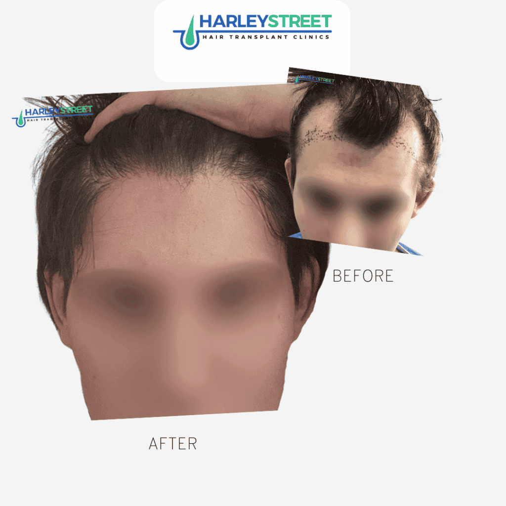 Charlotte-trans-before-and-after